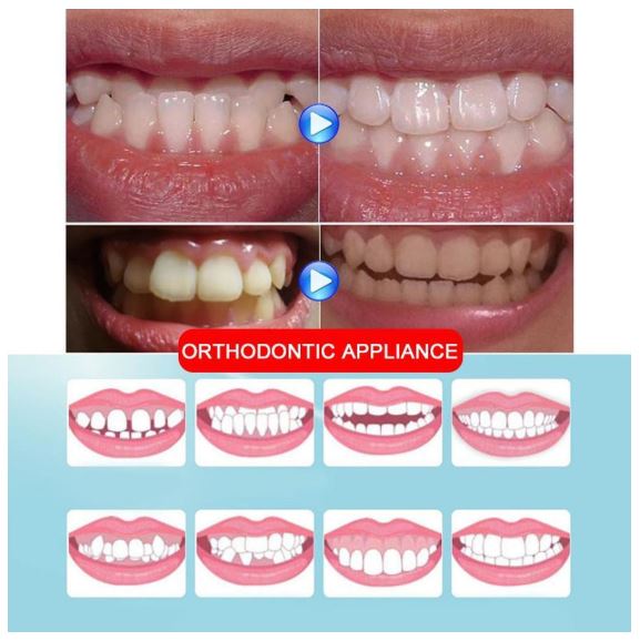 Plus Protections™️ Teeth Straightener (50% OFF)
